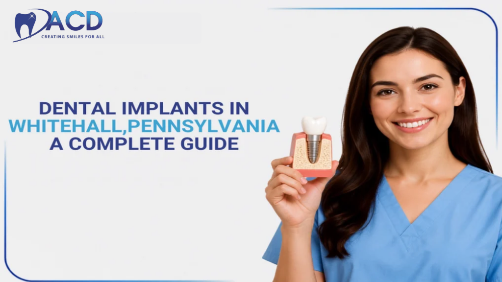 Dental Implants in Whitehall, Pennsylvania: A Complete Guide